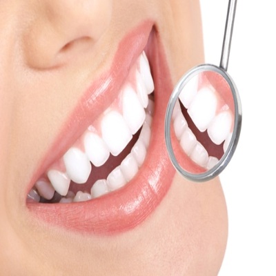 teeth-whitening